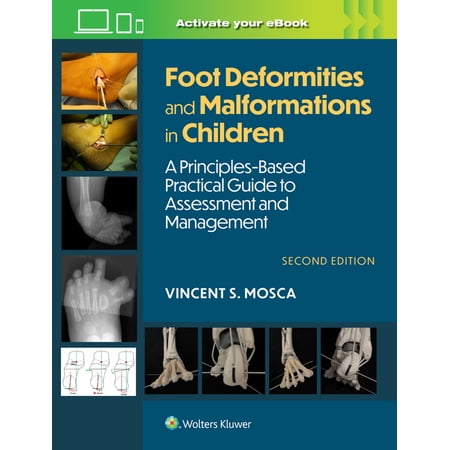 Foot Deformities and Malformations in Children: A Principles-Based Practical Guide to Assessment and Management: Print (Hardcover)