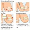 thumbnail image 1 of Toenail Correction Tool  Toenail Recover Tool  Foot Care Tool 6 In 1 Set Ingrown Toe Nail Fixer Pedicure Toenail Recover Correction Tool Nail Foot Care 02#, 1 of 8