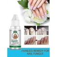 thumbnail image 3 of Onychomycosis Repair Liquid Nail Treatment Liquid Thicken Soft Nails Anti-funga, 3 of 3