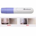 thumbnail image 3 of Handheld Electric Facial Skin Cleaning Maquillaje Pore Limpiador Limpiador Blackhead Zit Acné Herramienta De Eliminación De Succión SM SunniMix Herramienta limpia negra, 3 of 8