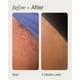thumbnail image 3 of Suero t&#2013265923pico para pelos encarnados High Roller | T&#2013265923nico roll-on para aliviar y calmar la piel irritada en el rostro, las axilas y, 3 of 8