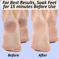 thumbnail image 6 of 3 in 1 Foot File, Double Sided Foot Scrubber, Callus Remover, Pedicure Foot Spa Products, Pedicure Tools for Feet, Dead Skin Scraper Foot Care, The Foot Medic, 6 of 6