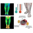 thumbnail image 3 of Calcetines de fisioterapia antiedema de tobillo, 3 piezas, calcetines moldeadores con autocalentamiento y circulación térmica, 3 of 3