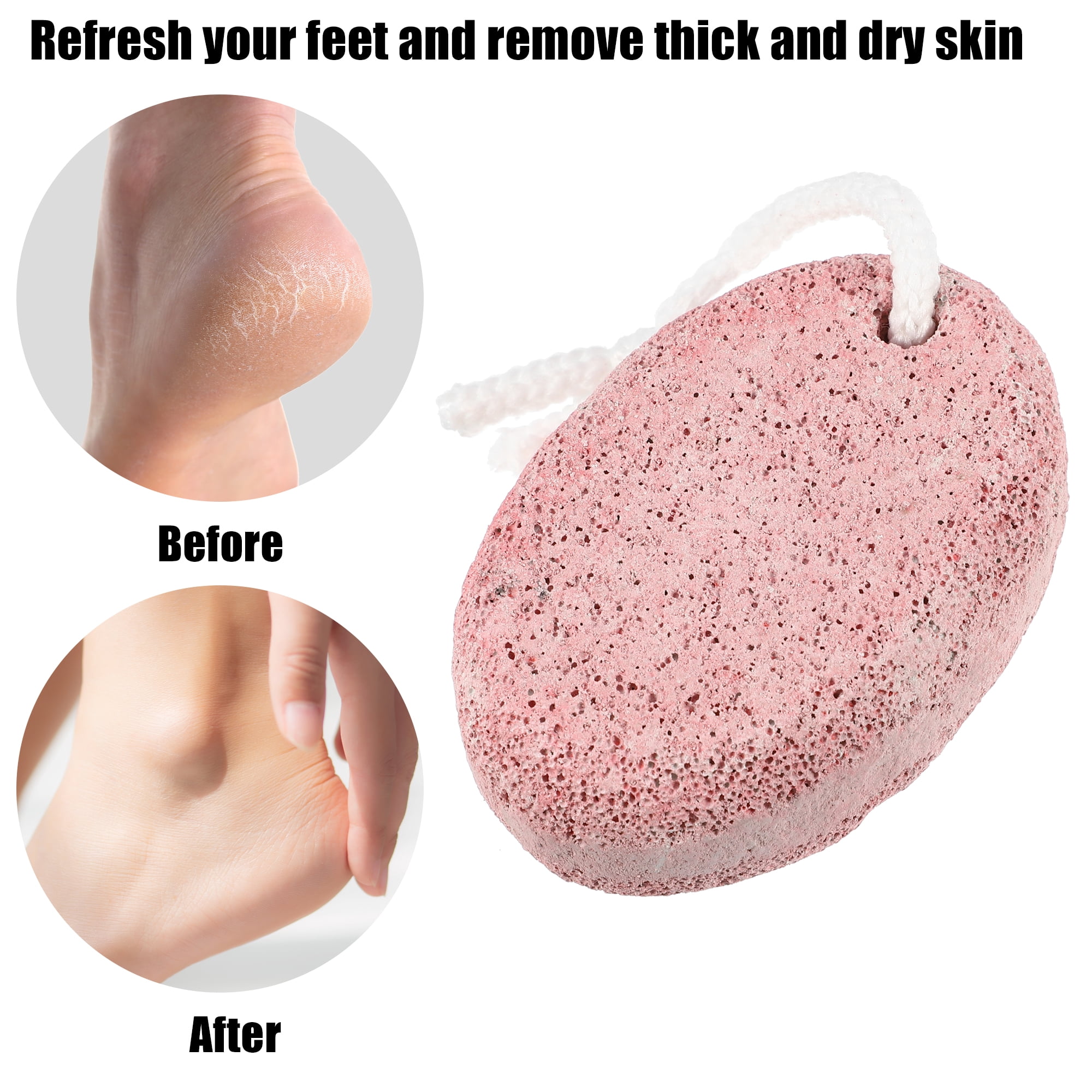 Unique Bargains 2 Pcs Foot Care Exfoliating Scrub Stone Pumice Stone Foot File Pink