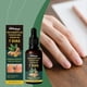 thumbnail image 2 of SOUTH MOON Nail Care Serum 30ml 7 Days Ginger Growth Serum Nail Fungus Treatment for Nail Growth, 2 of 5