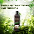 thumbnail image 3 of Ringshlar Hair Shampoo for Tinea Capitis Antipuritic Professional Antidandruff Remove Mites and Relieve Itching Shampoo 100ml, 3 of 7