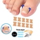 thumbnail image 4 of Corrector de uñas encarnadas Pegatinas para el cuidado de los pies Pegatinas para uñas sin pegamento TFixol Pegatinas correctoras de uñas, 4 of 7