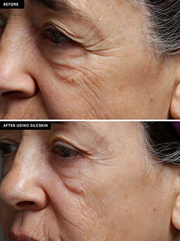 SilcSkin Full Face Set