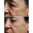 thumbnail image 5 of SilcSkin Full Face Set, 5 of 11