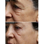 SilcSkin Full Face Set