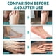 thumbnail image 4 of Teissuly 30g Hand And Foot Numbness Repair Korean Skin Body Beauty Cream Pain Cream Teissuly WER202401226966, 4 of 9
