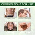 thumbnail image 4 of Aceite Esencial de Romero para Cuidado de la Piel y Crecimiento del Cabello 30 ml, 4 of 7