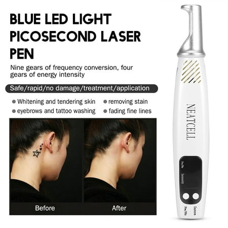 Yosoo Handheld Picosecond Laser Pen Tattoo Scar Freckle Removal Machine Skin Beauty Device, Beauty Device, Tattoo Removal Laser (Best Small Hand Tattoos)