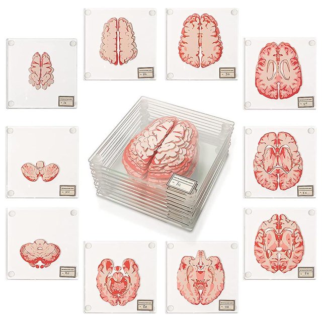 Posavasos anatómicos con muestras de cerebro, regalos para estudiantes de medicina, decoración del cerebro, regalos de anatomía humana