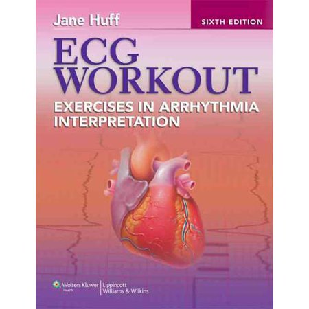 ECG Workout: Exercises in Arrhythmia Interpretation