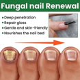 thumbnail image 5 of EELHOE 30ml Nail Treatment Essence for Onychomycosis Mild Non-irritating Nail Bright Shiny Repair Nail Repair Solution, 5 of 5