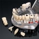 thumbnail image 5 of 2025 Modelos dentales Modelos de resina reparables de dientes enfermos para la enseñanza y la investigación en medicina y enfermedades dentales, 5 of 5