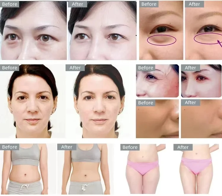 3 in 1 Cavitation Ultrasonic Weight Loss Lifting Wrinkle Firming Skin Slimming Body Massage Shaping Beauty Instrument