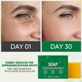 thumbnail image 6 of Turmeric Lemon Soap Bar – For Dark Spots, Nourishing & Clarifying Facial & Body Skin, Suitable for Dry & Oily Skin – Gentle Daily Cleanser (2PCS), 6 of 7