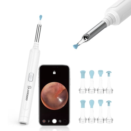 VITCOCO Ear Wax Removal, Wireless Ear Cleaner with 1296P HD Ear Camera and 3.9mm Ear Otoscope, Earwax Removal Tool with 6 LED Lights, Kids Adults Ear Cleaning Endoscope for iPhone Android Phones