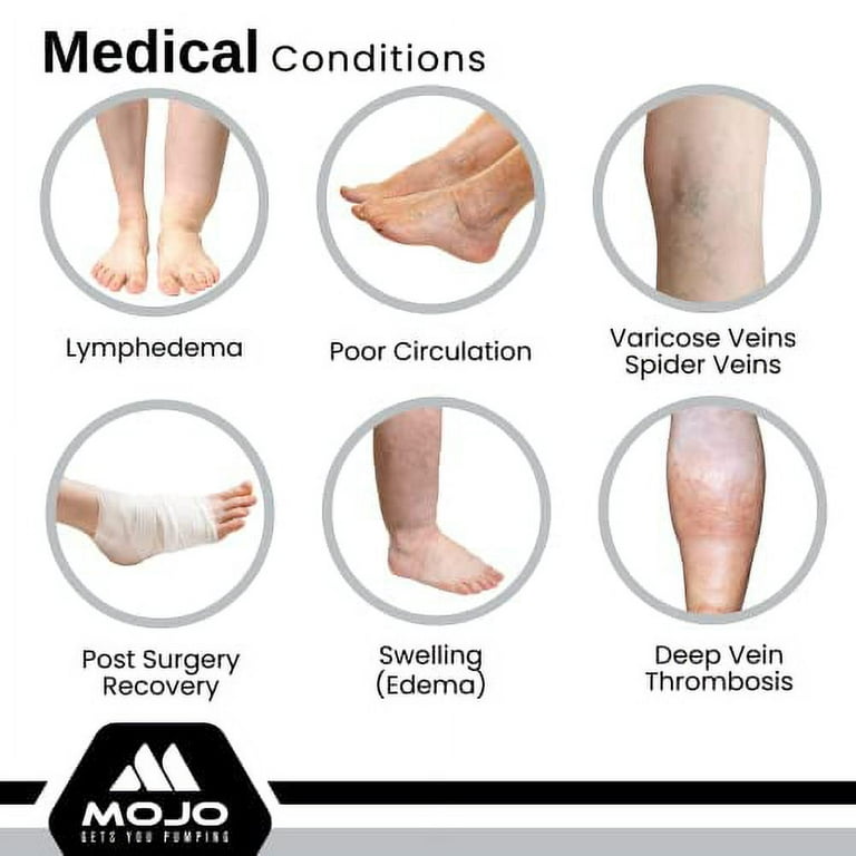 Mojo Compression Socks for Varicose Veins, Spider Veins, Swelling,  Lymphedema, DVT, and CVI