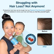 Baby Blues Postpartum Vitamins for New Moms, 3-in-1 Bundle for Hair, Immune and Digestion, 180 Count