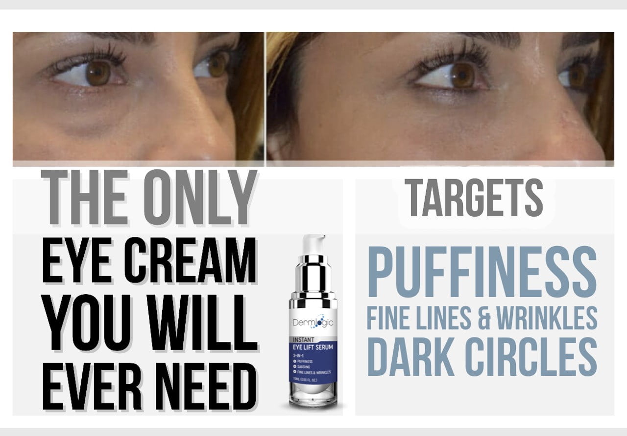 Dermlogic Instant Under Eye Puffiness, Dark Circles, Fine Lines Cream, 15 mL