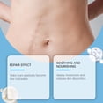 thumbnail image 3 of Scar Patch Soothing Relieving Inflammatory Hydrogel For Skin Recovery, 3 of 8