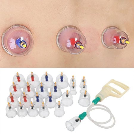 24pcs U-shape Cups Chinese Vacuum Cupping Set Massage Therapy Suction (Best Chinese Massage London)