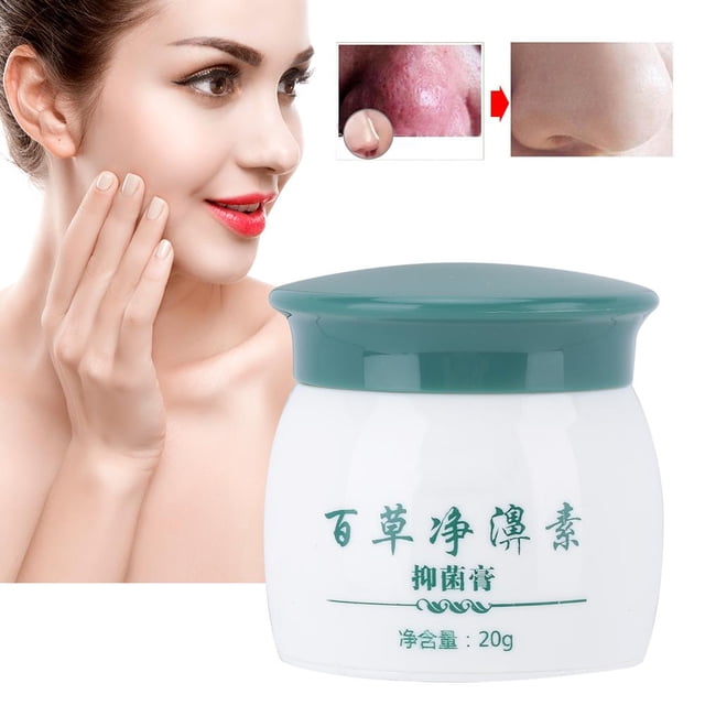 Crema Para La Nariz Tratamiento Para La Rosácea 20g Crema Antibacteriana Para La Nariz A Base De Hierbas Tratamiento Para La Rosácea Crema Limpiadora Para El Enrojecimiento ANGGREK Otros