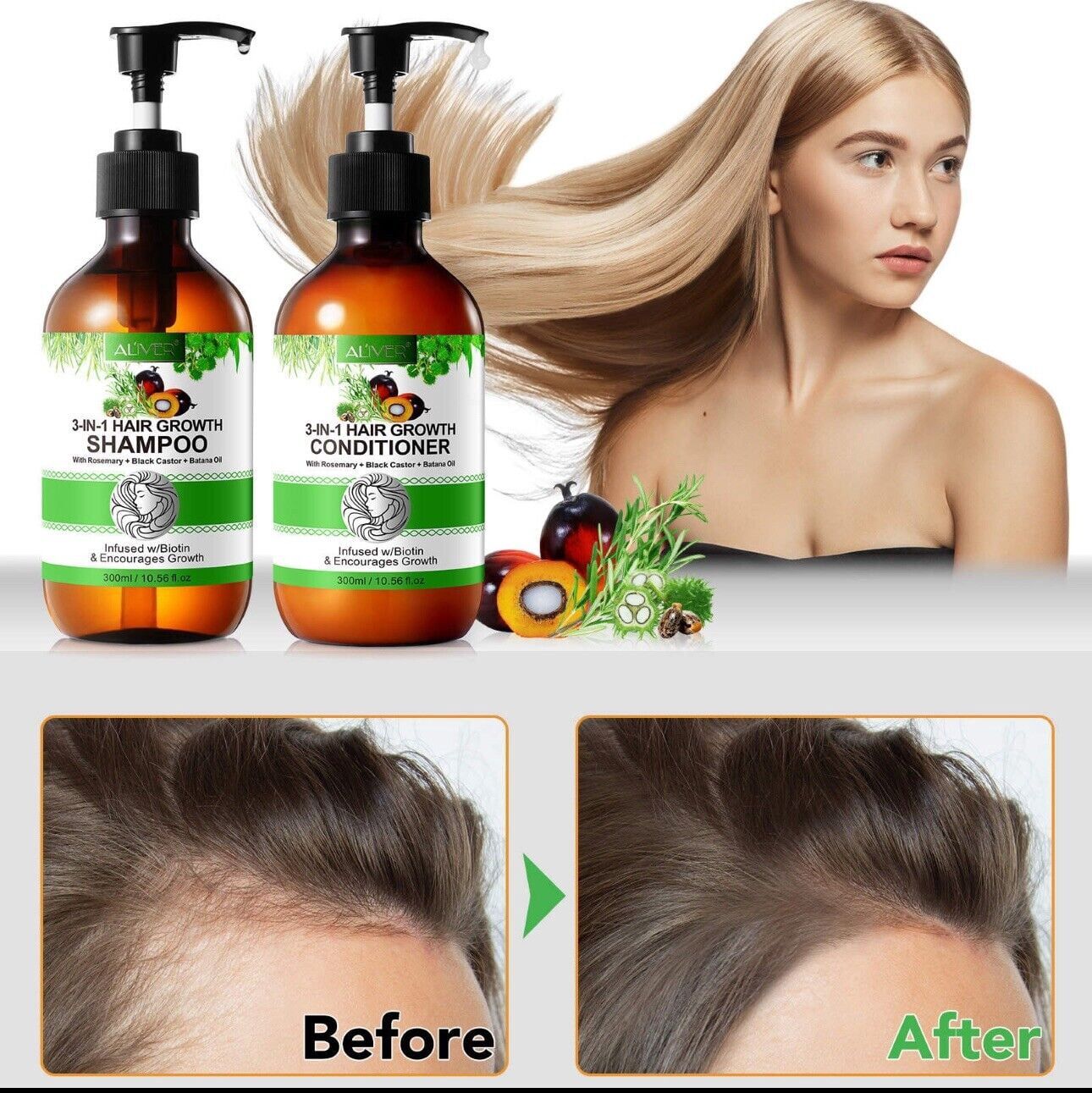 3in1 Hair Growth Shampoo/Conditioner set with Biotin ,Jamaican Black Castor Oil + Rosemary Oil + Batana oil (Shampoo and Conditioner) All Natural Ingredient