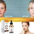 thumbnail image 1 of XWSHYW Esencia Vitaminc Facial Desaliniza Las Líneas Finas para Eliminar Las Impresiones, Ilumina El Tono de La Piel, Hidrata y Reafirma La Piel 30Ml, 1 of 6