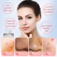 thumbnail image 4 of Outil de Suppression des Imperfections des Points Blancs Kit d'Outils Popper 8 Pcs, 4 of 5