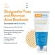 thumbnail image 2 of Mascarilla facial sin acné que elimina el acné con azufre y vitamina C, 50 ml, 2 of 6