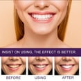 Musatteng Braces Brushes for Cleaning Purple Tooth Agent Toothpaste