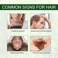 thumbnail image 2 of Aceite de romero de 60 ml para el crecimiento del cabello y el cuidado de la piel - Aceite esencial de romero orgánico 100% puro para cejas y pestañas oso de fresa Hogar, 2 of 5