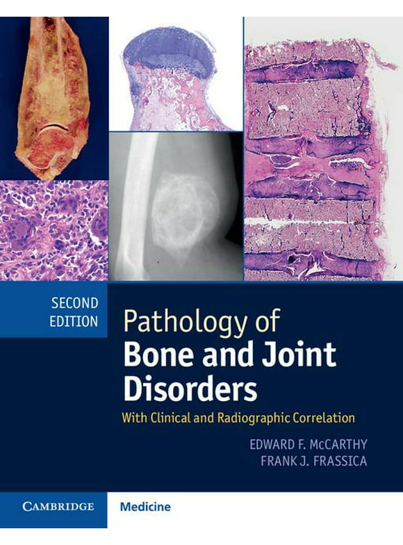 Pathology of Bone and Joint Disorders Print and Online Bundle: With Clinical and Radiographic Correlation (Other)