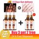 thumbnail image 1 of Suero blanqueador rápido para nudillos oscuros, Corrector de melanina para nudillos de manos, producto eliminador de manchas intensas para el cuidado de la piel negra, 50ml, 1 of 5
