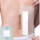 thumbnail image 1 of Funda de ducha Hola Health para vendaje de heridas, 25 unidades, 25 cm x 25 cm, 1 of 9