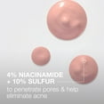 thumbnail image 4 of Neutrogena Stubborn Acne Spot Drying Acne Treatment, 10% Sulfur, 1 oz, 4 of 8