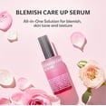 thumbnail image 2 of Serum isoi Blemish Care Up 70 ml con arbutina y aceite de rosa búlgara, 2 of 9