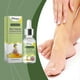 thumbnail image 2 of Bee Venom Nail Repair Essence, Bee Venom Treatment Serum Instant, Effective & Long-lasting, 2 of 5