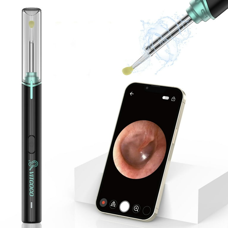 endoscope ear wax