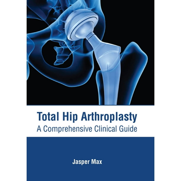 Total Hip Arthroplasty A Comprehensive Clinical Guide (Hardcover