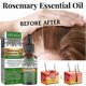 thumbnail image 5 of Rosemary Hair Growth Essential Oil Anti Hair Loss Fast Regrowth Essence Repair Damaged Frizzy Thinning, 5 of 5