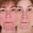 thumbnail image 3 of Set de cuidado de la piel Rodan + Fields Soothe Regimen para pieles sensibles, 3 of 6