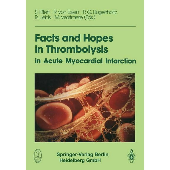 Facts and Hopes in Thrombolysis in Acute Myocardial Infarction, (Paperback)