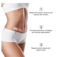thumbnail image 4 of Silicone Scar Tape(4*300cm) - Silicone Scar Sheets Strips for Professional Scar Removal, C-Section, Surgery, Burns, Keloid & Acne Scars, 4 of 5