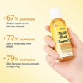thumbnail image 5 of 1-3x Stretch Marks Remover Essential Oil, Organic Natural Stretch Marks Oil, Nourishing Body Oil For Stretch Marks Care, 5 of 5