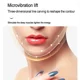 thumbnail image 4 of Masajeador Facial Y De Cuello Con Radiofrecuencia - Dispositivo Antiarrugas Con Luz Roja/Azul, Lifting No Invasivo, Recargable USB Para Cuidado De La Piel, 4 of 11